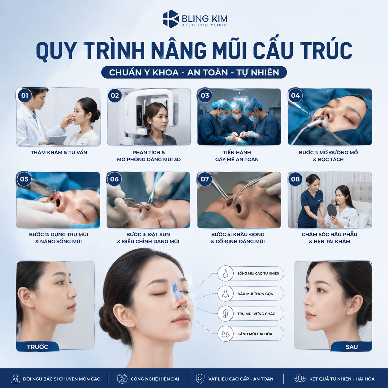Quy trình nâng mũi cấu trúc chuyên nghiệp an toàn tại Bling Kim