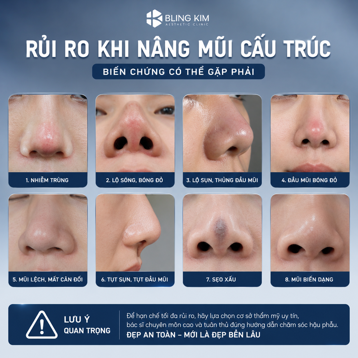 Nâng mũi cấu trúc có thể gây ra những rủi ro ngoài ý muốn nếu không chọn đúng địa chỉ uy tín